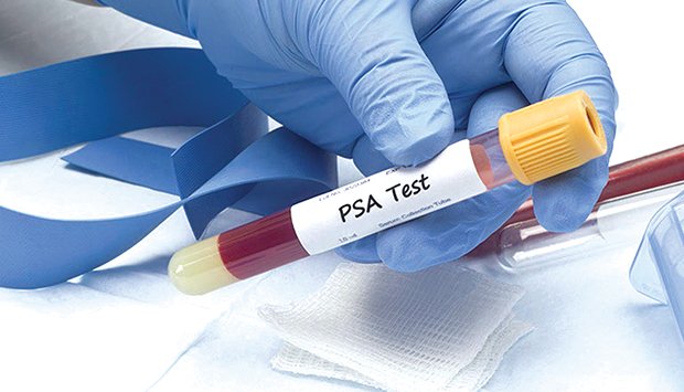 Diagnosticados mais cinco casos de cancro da próstata