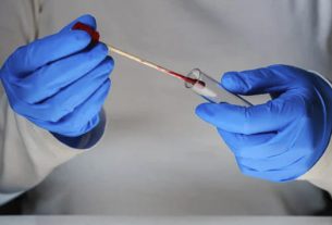 CIVICOP apela famílias das vítimas do 27 de Maio para realização de testes de ADN
