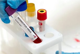 Angola regista dois novos casos de Mpox e três altas médicas em 24 horas