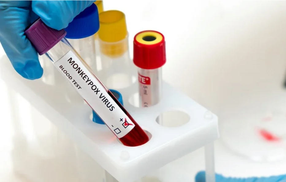 Angola regista dois novos casos de Mpox e três altas médicas em 24 horas
